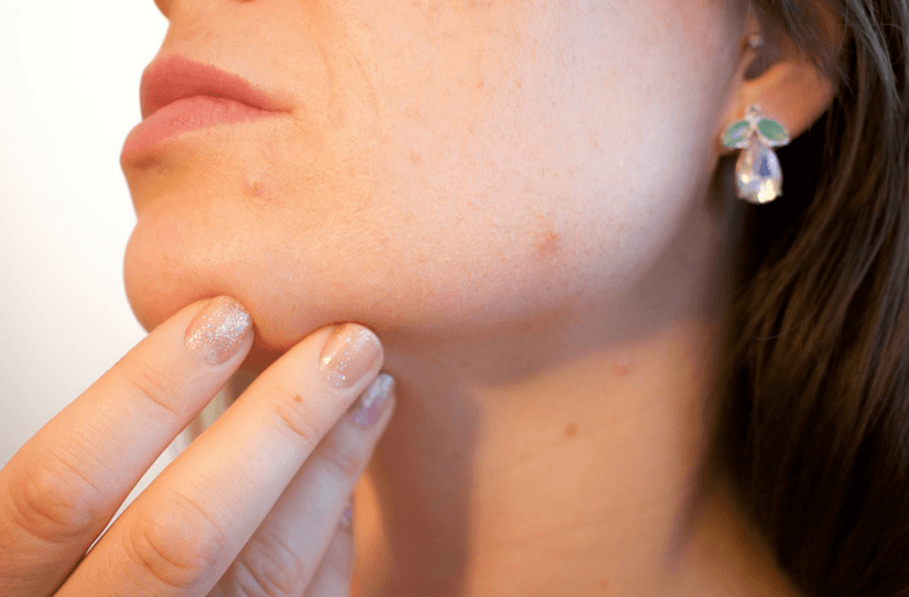 O que causa problemas de pele segundo a Germânica Heilkunde?