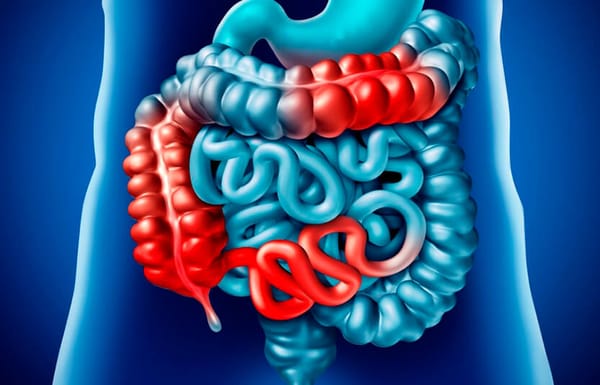 Intestino Delgado e Doença de Crohn pela Medicina Germânica Heilkunde