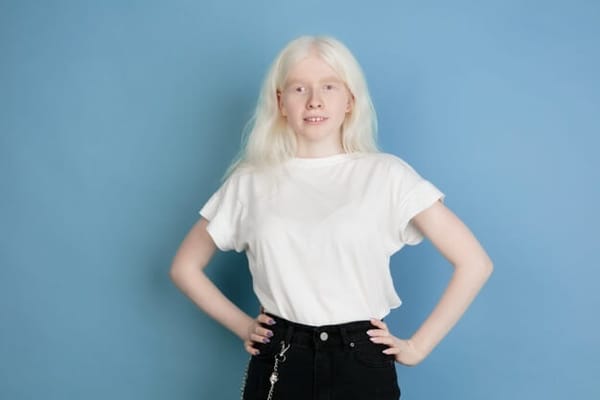 Albinismo pela Medicina Germânica Heilkunde
