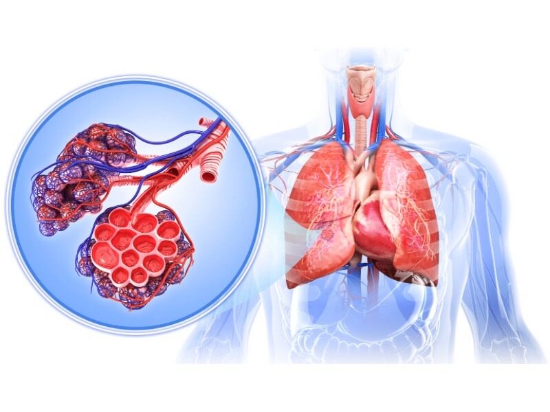O que é enfisema pulmonar pela Medicina Germânica?